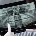 RADIOLOGÍA PERIAPICAL